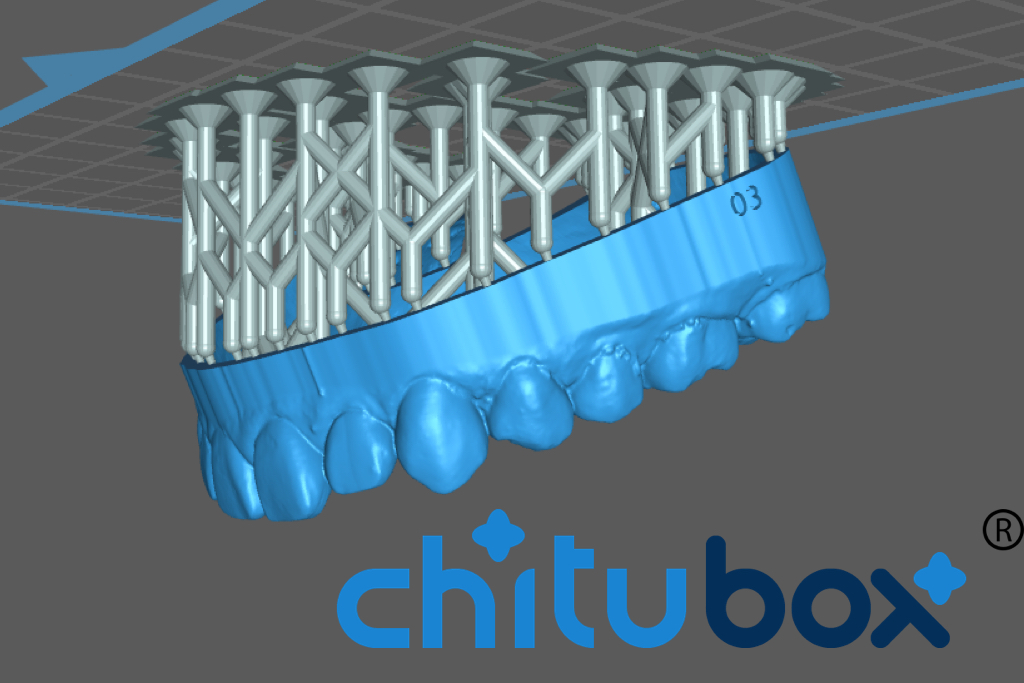 add supports to tooth model