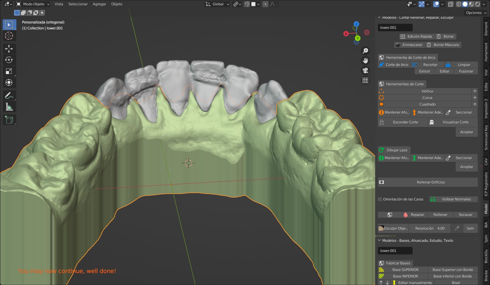 tooth model