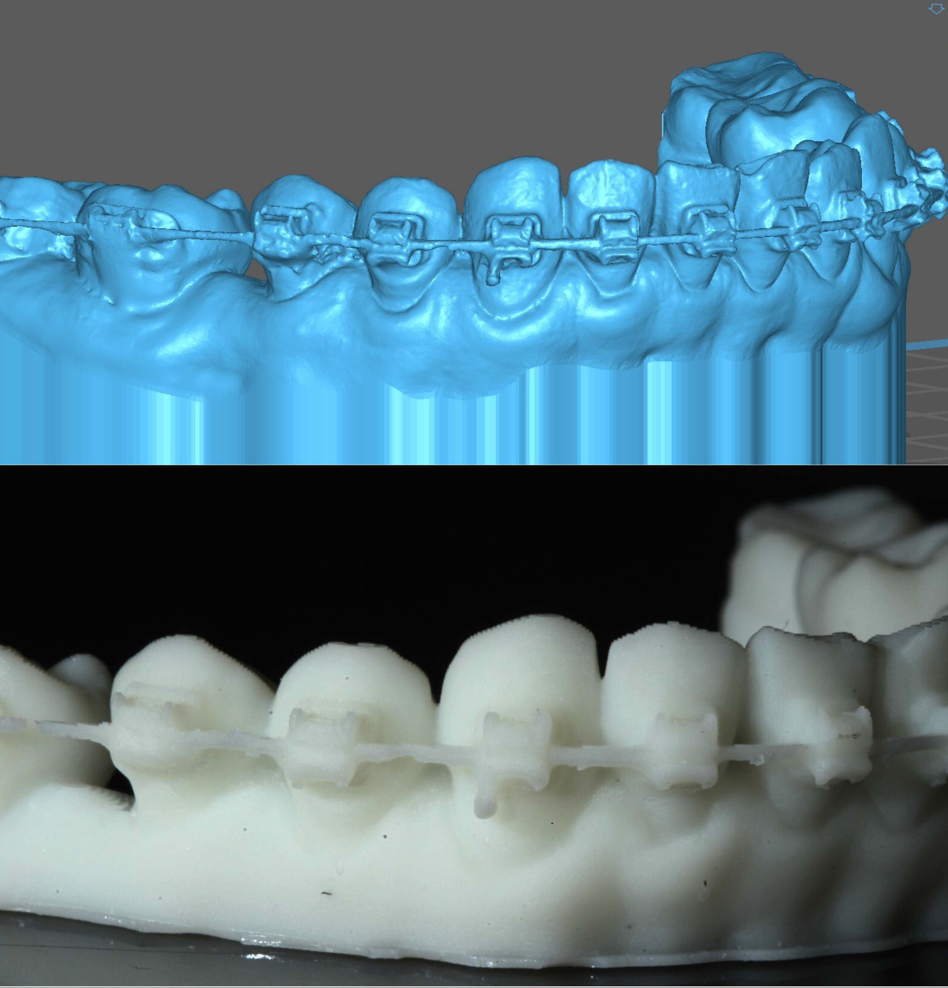 tooth model